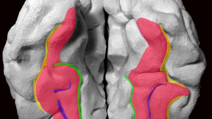 Fusiform Gyrus مناطق تمييز الوجوه Fusiform Gyrus مناطق تمييز الوجوه