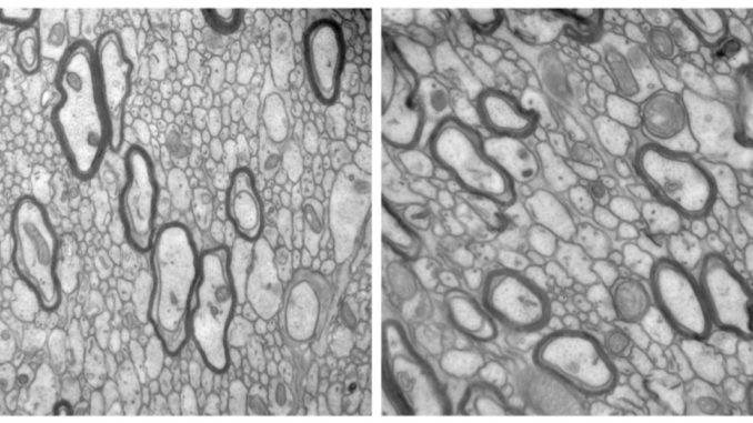 Electron microscopy Electron microscopy