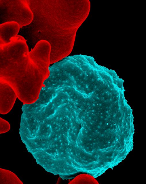 خلية دم حمراء مصابة بالملاريا