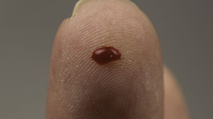 وخز الأصابع وخز الأصابع