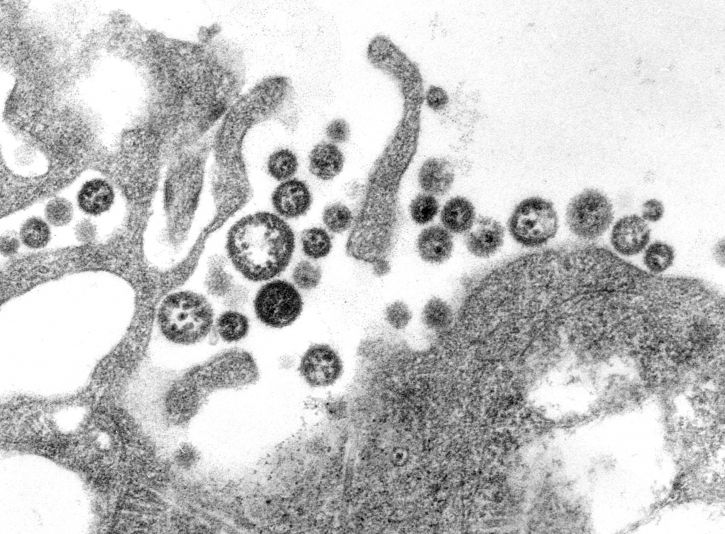 هل الفيروسات كائنات حية؟! هل تكون الفيروسات أصل الحياة؟  