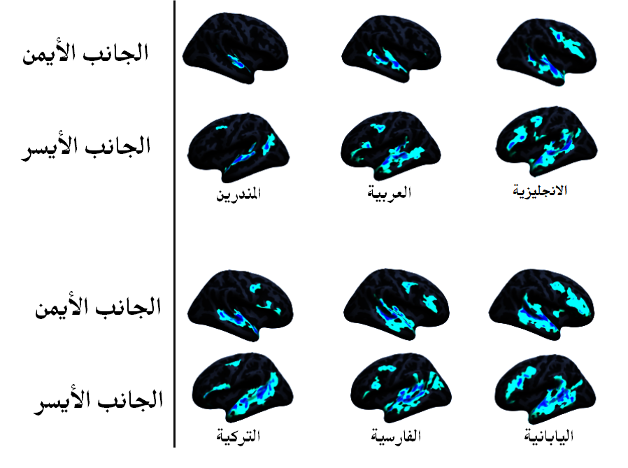 شبكة اللغة في الدماغ تحت ضوء دراسة 12 عائلة لغوية و45 لغة