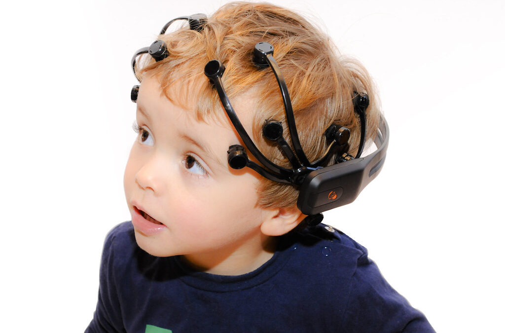 هل استخدام تخطيط كهربية الدماغ في التشخيص النفسي مفيد؟